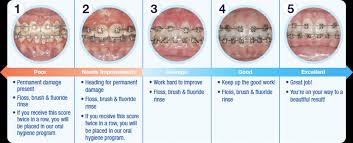 Brush the outer surfaces of your teeth and braces, remembering to scrub around each bracket and over its surfaces. Braces Care Instructions Armbrecht Wierenga Orthodontics