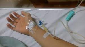 Pengertian pemasangan infus pemasangan infus adalah salah satu cara atau bagian dari pengobatan untuk memasukkan obat atau vitamin ke dalam tubuh pasien darmawan 2008. Pin Di Cntik