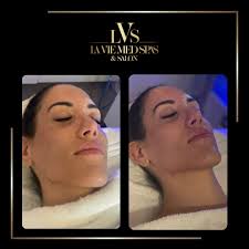 Sculpt. Smooth. Glow. Defy gravity this fall with our L'Essentiel Lift, a  non-surgical facial rejuvenation that combines Microneedling, PRP, and  Exosomes for immediate radiance and firmer skin. For this month only, enjoy