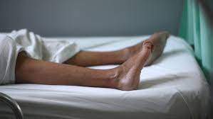 And&#160;which presents as acute generalized weakness. What Is Guillain Barre Syndrome Cnn Video