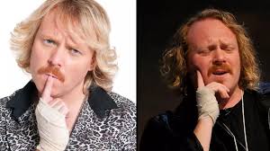 Real reason Keith Lemon always wears a bandage