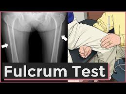 Image result for Fulcrum Test
