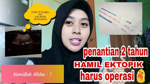 Kemungkinan kehamilan di luar rahim (ektopik) terjadi pada 7 dari 1000 kehamilan. Pengalaman Ku Hamil Ektopik Hamil Di Luar Kandungan Penantian 2 Tahun Harus Operasi Youtube