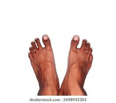 Image result for toe black diabetes