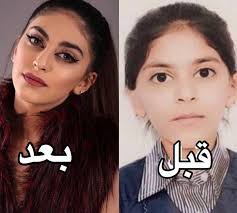 ا on twitter شوق محمد قبل وبعد