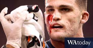 Maybe you would like to learn more about one of these? Nathan Cleary Risks Reopening Deep Facial Scars With A Quick Backup Of Penrith Panthers Sydney News Today