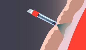 Read on to find out how your weight may affect the size of the needle used for your vaccine, and for more essential vaccine news, pfizer ceo says this is exactly when you'll need another covid. Needle Free Injections Preparing For Mass Vaccination