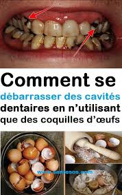 Pin On Soins De Beaute