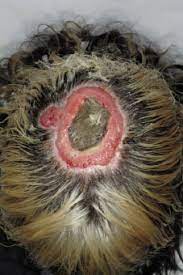 Using hair dye on hair recently treated with a relaxer, permanent wave, straightening treatment, or other chemical treatment can result in scalp burns and hair damage. Chemical Burns To The Scalp From Hair Bleach And Dye Html Acta Dermato Venereologica