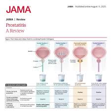 Image result for Chronic Bacterial Prostatitis