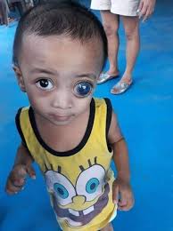 Johnny Anthony Ello Bana-ag