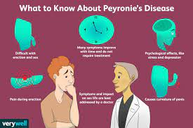 Peyronie S Disease Signs Symptoms And Complications