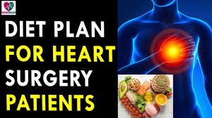 58 Judicious Diet Chart After Cabg