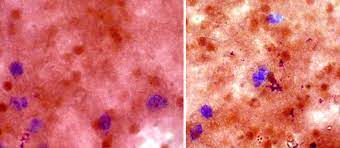 After registering with an institution and the entire nbt registration process is done online through the nbt website, and you can use a. Positive Nbt Test When A Represent Nbt Test From Blood Derived By Download Scientific Diagram