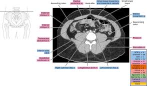 ƒ organs and structures of the female pelvis. Ct Pelvis Anatomy Muscles Medical Imaging And Radiological Anatomy X Ray Ct Mri Kenhub Anatomical Drawing Of The Female Pelvis