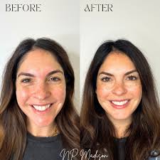 MEET ➡️ Brian Gulbranson : Bioresonance