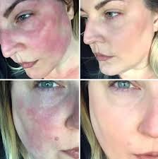 Always love that feeling healing from the center-out