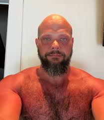 No the sun does not really burn as it is not