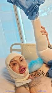 mary magdalene surgery xxx - Sexy photos