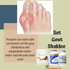 Cuma persoalannya, apakah punca gout menyerang? Bahaya Penyakit Gout Shidarahmat