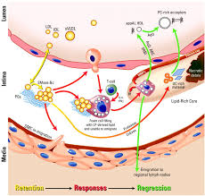 Formation Of Atheroma Google Search Hdl Ldl Cell Lymph Nodes