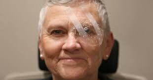 Huit Conseils Pour Reduire Le Temps De Recuperation Apres Une Chirurgie De La Cataracte Tout Sur La Vision