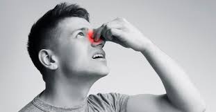 تورم عظمة الأنف وكيفية العلاج ويب طب