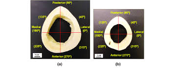 Man kauft online den paketschein, bezahlt per paypal. Bone Cross Section Schematic Diagram Of Long Bone Cross Section 47 Download Scientific Diagram Click On The Tags Below To Find Other Quizzes On The Same Subject Monangsinulingga