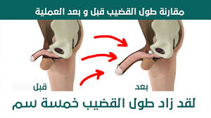 الكركم من التوابل اللذيذة وهو مفيد فى علاج (النيوماتودا) ويحتوى الكركم على عدة مركبات ذات نشاط مضاد للطفيليات والديدان وهى من الاعشاب القويه القاتلة للديدان.يمكن اخذ الكركم كمسحوق ويمكن اضافته. Ø§ÙØ¥Ø­Ø¨Ø§Ø· Ø®Ø±Ø² Ø§Ø³ØªØ¬Ø§Ø¨Ø© Ø§Ø·Ø§ÙØ© Ø§ÙØ°ÙØ± Ø¨Ø§ÙØ§Ø¹Ø´Ø§Ø¨ Knockerballmissoula Com