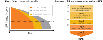 Proceedings of the acute dialysis quality initiative (adqi) xi workgroup. Chronic Kidney Disease Stage 4 5 Management