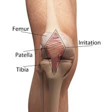 Image result for Patella Mobility Test