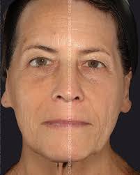 Chaque peau raconte une histoire — encore faut-il savoir bien l'écouter.  Dre Brassard revient sur une situation mal diagnostiquée, et explique  comment un œil expert et une bonne écoute peuvent tout changer.