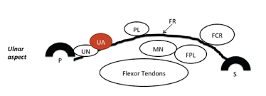 Tendon pulley reconstruction, with local tissues separate procedure (26500) tendon pulley reconstruction; Using Ultrasound To Diagnose Carpal Tunnel Syndrome Page 2 Of 6 The Rheumatologist