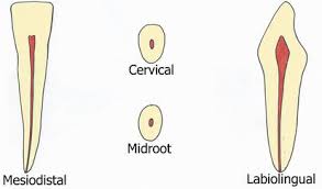 The mesiodistal dimensions of the maxillary teeth showed a higher variability than the mandibular teeth, with the first molar dimensions showing the greatest variability. Permanent Maxillary And Mandibular Incisors Intechopen
