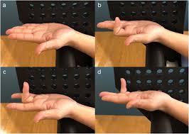 To check fds function, hold all adjacent fingers in extension and then release the finger you want to assess. Valgus Stability Is Enhanced By Flexor Digitorum Superficialis Muscle Contraction Of The Index And Middle Fingers Journal Of Orthopaedic Surgery And Research Full Text