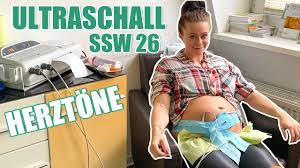 Komme die woche in die 27 ssw und wollte mal wissen wann das gemacht wird. Die Ersten Herztone Unserer Tochter I Live Beim Ultraschall Ctg Ssw26 Youtube