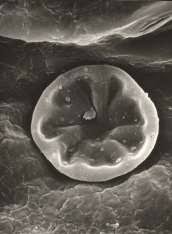 Image result for Rothia hirsuta