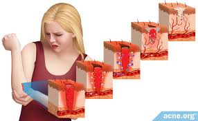 Image result for Wound Repair