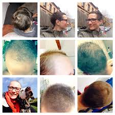 Frisurentrends 2014 neue frisuren für frauen. Eine Haarige Angelegenheit Hairy Affairs Diagnose Leben