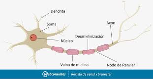 Los síntomas son debilidad muscular, . Causas Del Sindrome De Guillain Barre