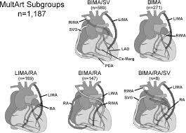 In human anatomy, the internal thoracic artery (ita), previously commonly known as the internal mammary artery (a name still common among surgeons), is an artery that supplies the anterior chest wall and the breasts. Multiple Arterial Grafts Improve Late Survival Of Patients Undergoing Coronary Artery Bypass Graft Surgery Circulation