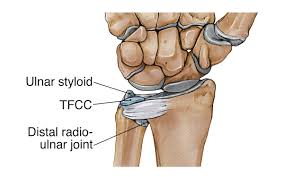 Image result for Normal Anatomic Position of the Hand and Wrist
