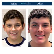 BellaSmiles Orthodontics added...