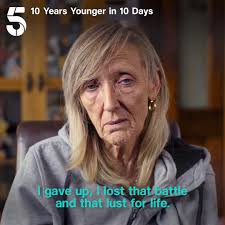 After a life changing accident and the passing of her husband, Jackie had  given up. But she's ready to move past the trauma and feel like herself  again., 10 Years Younger in 10 Days continues tonight ...