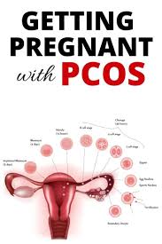 Pin On Pcos Diet