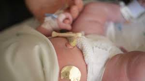 yeni dogan bebek kakasi bebaby anne ve bebek egitimi