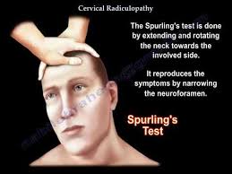 Bandscheibenvorfall • Medizinisches Portal de.MEDtube.net