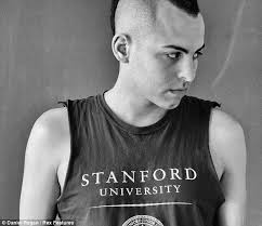 Alopecia Highlighted By New Photography Collection