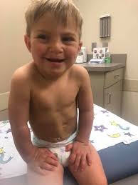 There was something wrong with their fetus, but they refused to have an  abortion: 2 years later they are happier than ever