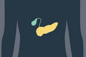 Diagnosing pancreatic cancer usually happens when someone comes to the doctor after experiencing weeks or months of symptoms. How To Lower Your Risk Of Future Pancreatitis Attacks Health Essentials From Cleveland Clinic